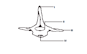 The vertebra illustrated is

